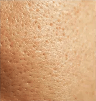 Pores + Shine Img