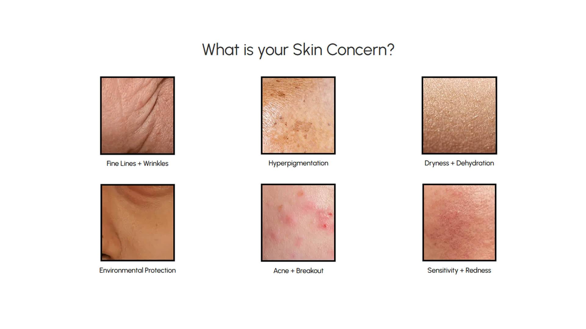 Skin Concern